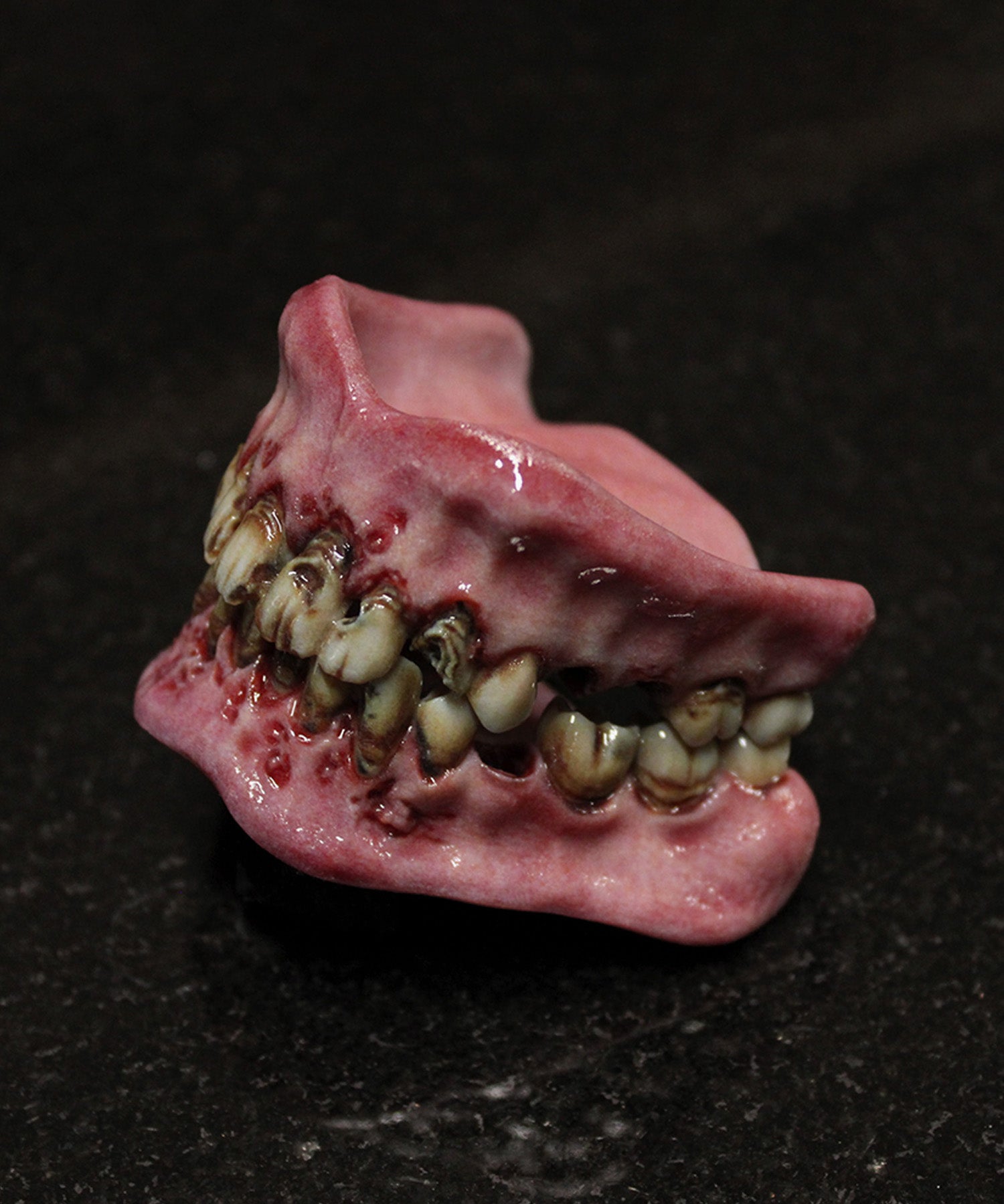 Retched Artificial Teeth Set