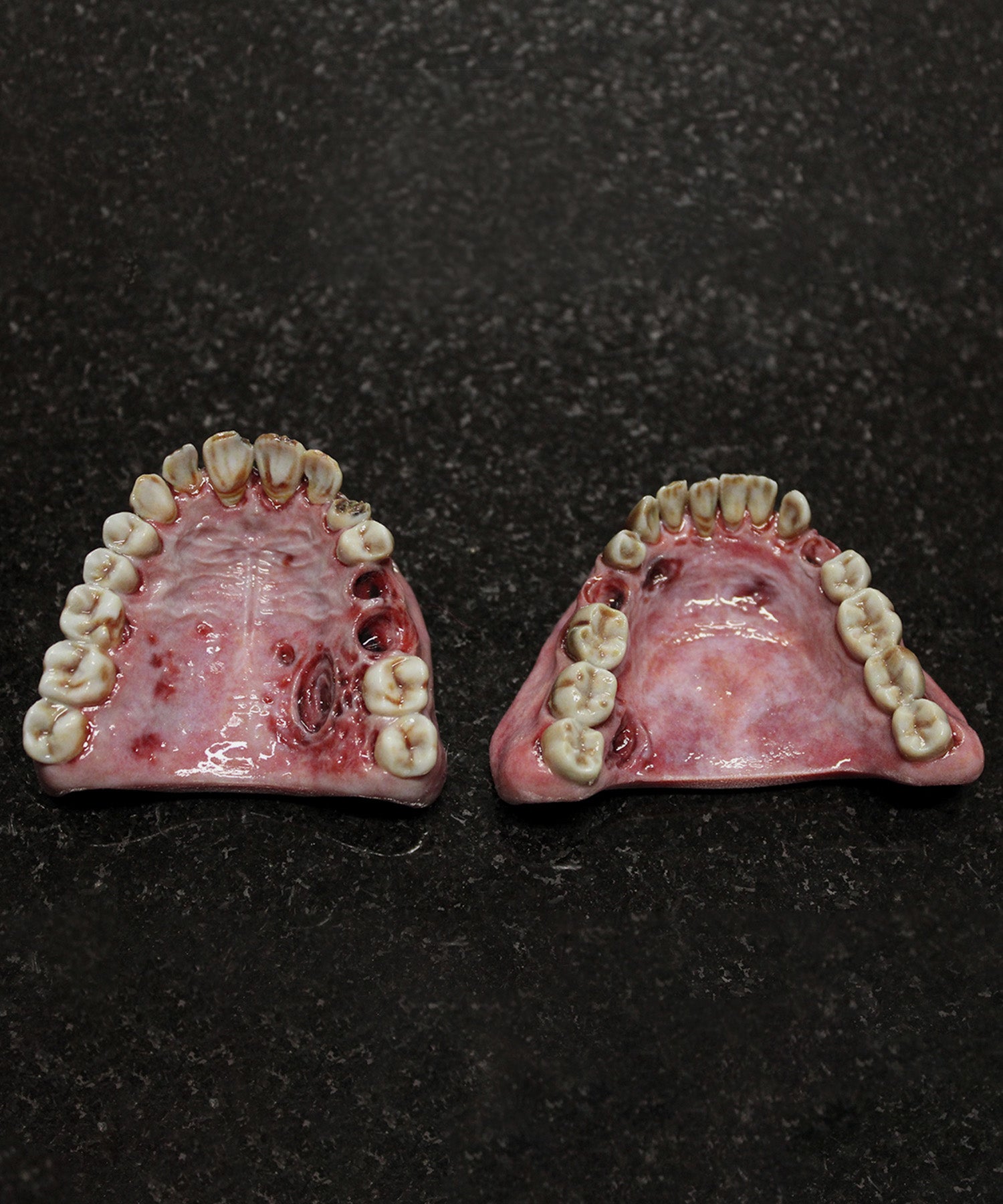 Retched Artificial Teeth Set