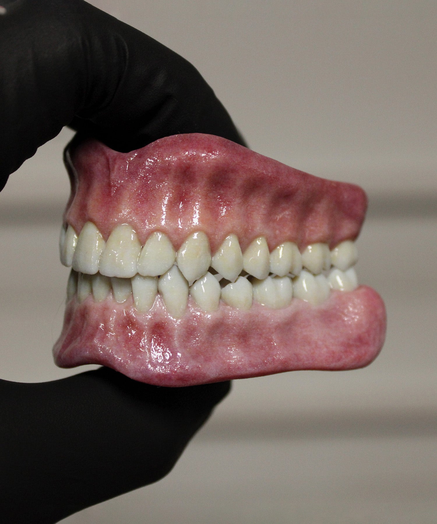 Pearly White Artificial Teeth Set