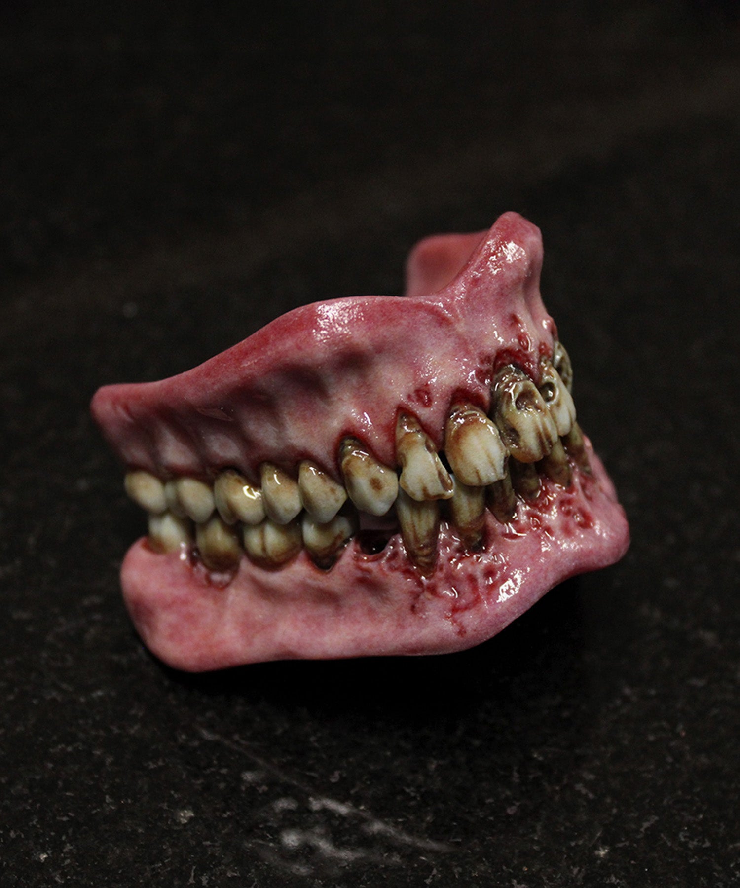 Retched Artificial Teeth Set