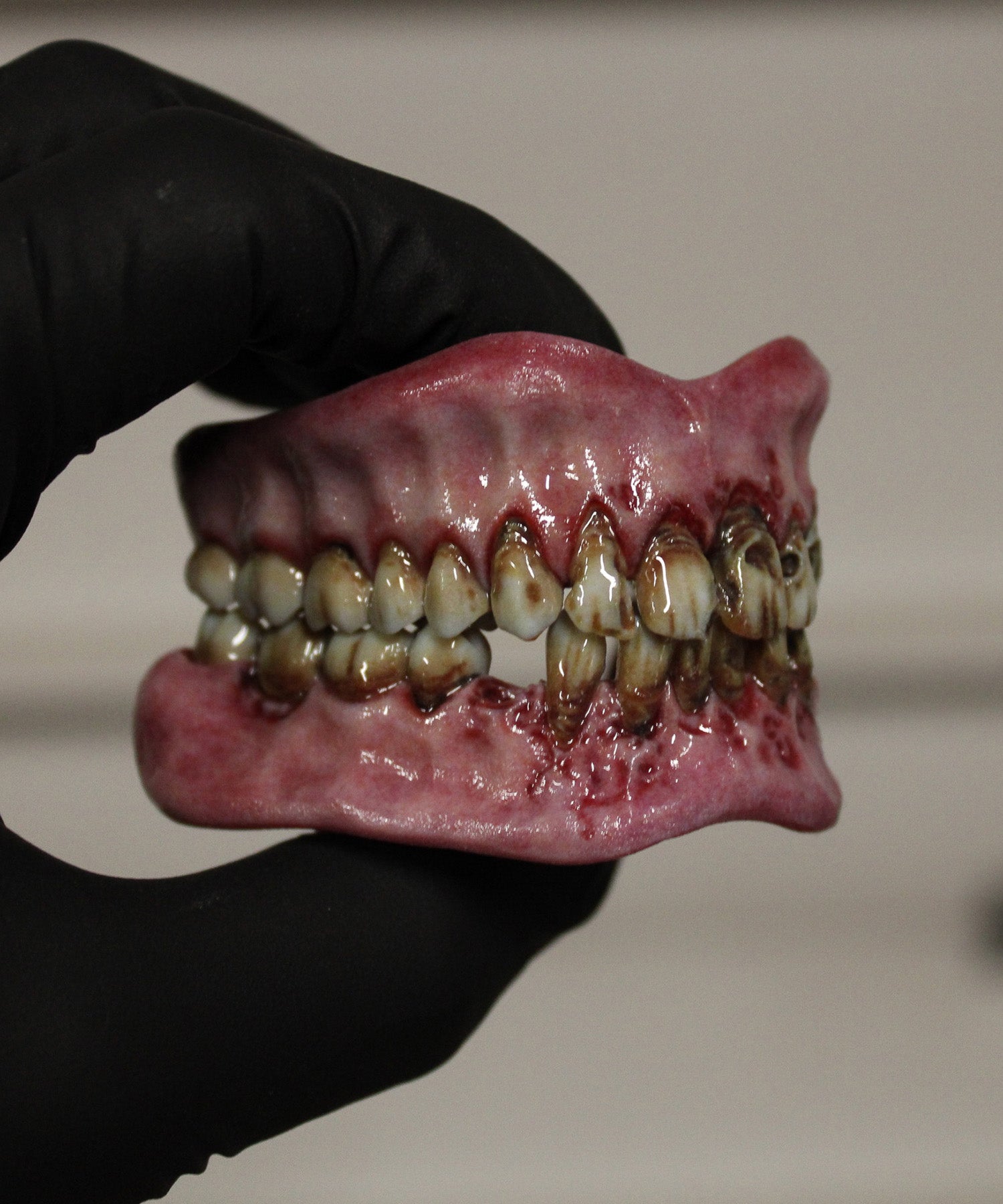 Retched Artificial Teeth Set