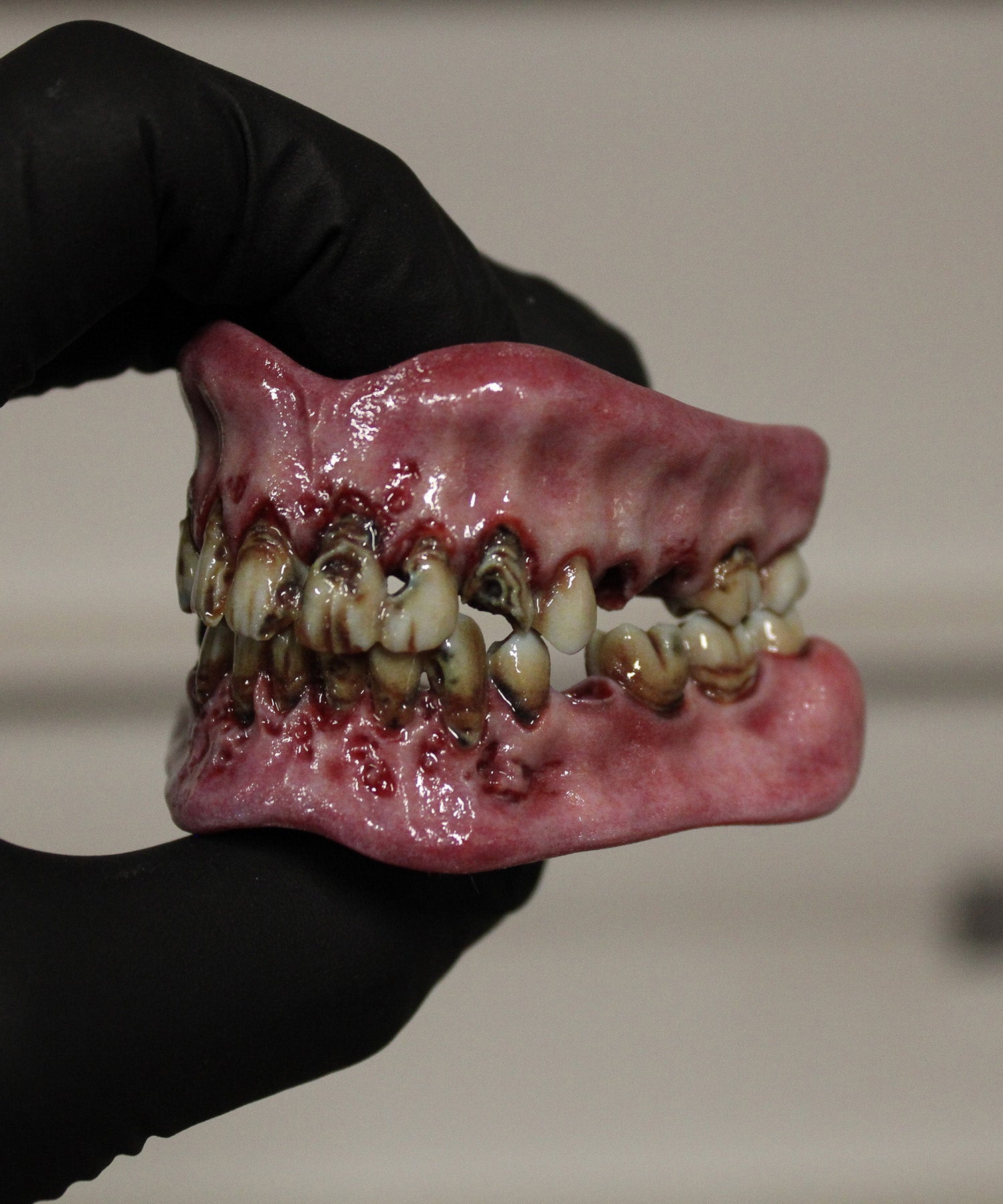 Retched Artificial Teeth Set